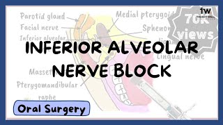 Inferior Alveolar Nerve Block Technique [upl. by Jolanta]