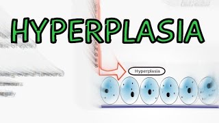 Metaplasia  Difference between Metaplasia and Dysplasia  Dysplasia [upl. by Aslam]