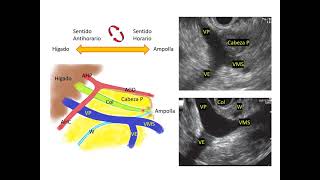 Anatomía hepatobiliopancreática aplicada a la ecoendoscopía [upl. by Ocker]