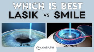 Laser Eye Surgery Lasik vs Smile  Dr ArulMozhi Varman  Uma Eye Clinic [upl. by Alvis]