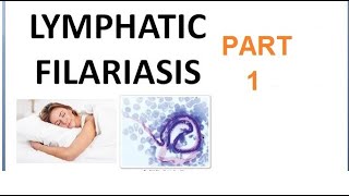 Parasitology 221 a Wuchereria Bancrofti Filariasis Filarial worm Elephantiasis Culex Microfilaria [upl. by Abrams]