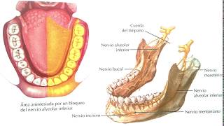 Anestesia nervio Alveolar Inferior Odontologia Chile [upl. by Eidualc]