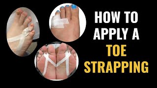 How Do I Do Toe Strapping Dislocated and Fractured Toe [upl. by Eddi107]