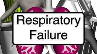 Nursing 101 Respiratory Failure [upl. by Lesly]