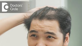 How to treat hair thinning in front part of the scalp  Dr Nischal K [upl. by Aman]