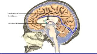 Upright Headache  my spinal CSF leak [upl. by Llenyl116]