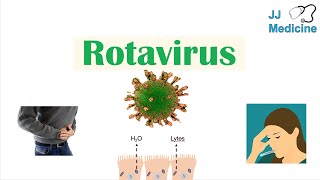 Rotavirus  Risk Factors Pathophysiology Symptoms Diagnosis Treatment [upl. by Ennayar]