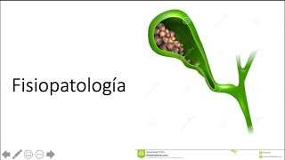 Fisiopatología de colelitiasis [upl. by Publus]