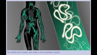 Lymphatic Filariasis Elephantiasis  Life Cycle [upl. by Mukund]