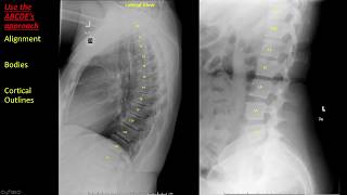 Abdominal Anatomy on Computed Tomography [upl. by Alaster]