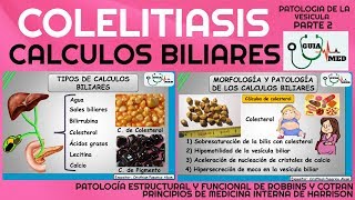 CÁLCULOS BILIARES FISIOPATOLOGÍA PARTE 2  GuiaMed [upl. by Farand400]