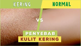 Ternyata Inilah Penyebab Kulit Kering [upl. by Modeste]