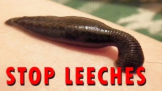 How to stop Leeches [upl. by Blayze]