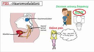 Probiotics Biofilms and Interstitial Cystitis Dr Tim Hlavinka on UTIs Part 2 [upl. by Avi642]