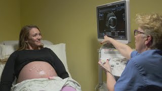 Ultrasounds during pregnancy [upl. by Mcconaghy738]