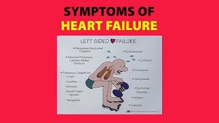 Symptoms of Heart Failure [upl. by Esilrahc]