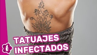 Tatuajes infectados cómo curarlos [upl. by Auhsuoj]