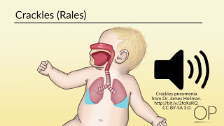 Respiratory Assessment by B Leary L DelSignore  OPENPediatrics [upl. by Nylassej259]