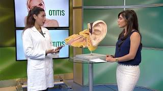 Causas y síntomas de la otitis HOY EN SALUD [upl. by Limak]