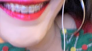 ASMR Whispering  About My Dental Braces amp Other Things [upl. by Latini]