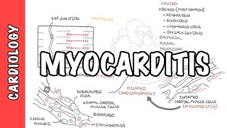 Myocarditis  causes pathophysiology investigation and treatment [upl. by Oiluj]