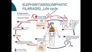 ElephantiasisLYMPHATIC FILARIASIS [upl. by Midge]