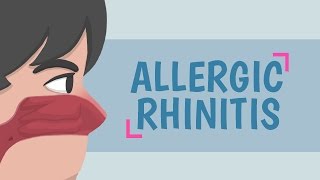 What is Allergic Rhinitis [upl. by Llerrej448]