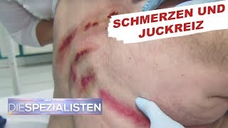 Krasser Hautausschlag  Auf Streife  Die Spezialisten  SAT1 TV [upl. by Aiouqahs]