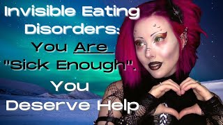 Your Eating Disorder Is Valid [upl. by Ancier]