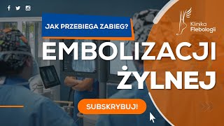 EMBOLIZACJA ŻYLNA  jak przebiega zabieg [upl. by Leuneb308]