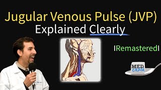 Jugular Venous Pulse JVP  Waveforms amp Evaluation for JVD [upl. by Eilram31]