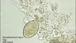 Diphyllobothrium latum egg [upl. by Ridan955]