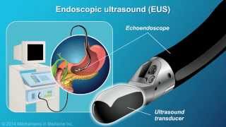 Understanding EUSFNA [upl. by Siva384]