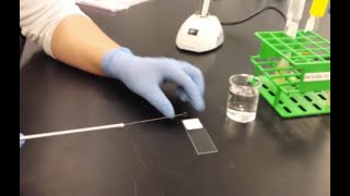 Bacterial smear preparation [upl. by Hurd8]