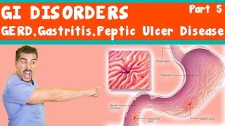 GI Disorders GERD Gastritis peptic ulcer Disease Part 5 [upl. by Myna726]