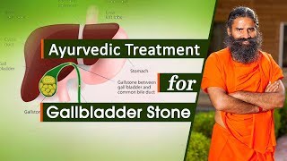 Ayurvedic Treatment for Gallbladder Stone  Swami Ramdev [upl. by Adi308]