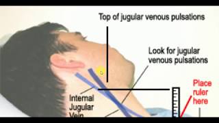 JUGULAR VENOUS PRESSURE  MEDICINE LECTURES  Cardiology Lectures [upl. by Hanid]