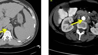 Introduction to Radiology Computed Tomography [upl. by Esille13]