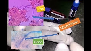 Microfilaria live and dead under Microscope [upl. by Eenyaj]