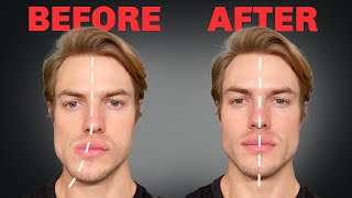 How to Fix Asymmetrical Jaw amp Face FOREVER [upl. by Arlana755]