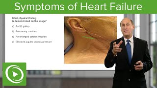 Symptoms of Heart Failure – Cardiology  Lecturio [upl. by Ainerol]