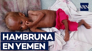 85000 niños han muerto de hambre en Yemen en los últimos cuatro años [upl. by Yevoc323]