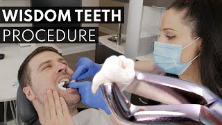 Wisdom Teeth Extraction PROCEDURE  How to Prepare What to Expect amp Cost [upl. by Lau]