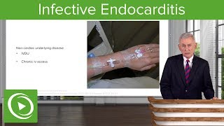 Infective Endocarditis IE Definition amp Epidemiology– Infectious Diseases  Lecturio [upl. by Niko]