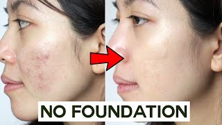 How to Cover Acne amp Blemishes WITHOUT Foundation • easy amp non cakey [upl. by Malas]