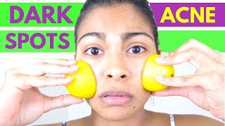 HOW TO APPLY LEMON ON FACE  Rubbing lemon on face [upl. by Howlyn]