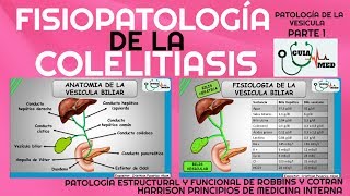 COLELITIASIS FISIOPATOLOGÍA GuiaMed [upl. by Aizat]