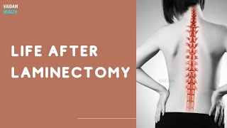 Life After Laminectomy [upl. by Akkire]