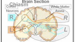 Learn About Migraine Aura [upl. by Proulx254]