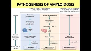 Cardiac Amyloidosis by Dr Mat Maurer [upl. by Hiller]